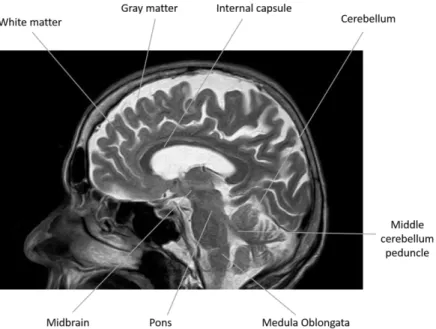 Figure 3. A sagittal brain section in which some of the main structures of the brains 