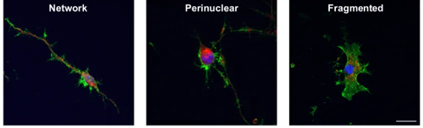 Figure  8.  Neuronal  morphology  and  mitochondrial  distribution  of  differentiated  NSPCs