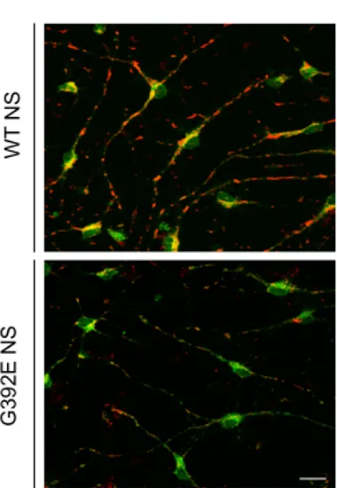 Figure  10.  Evaluation  of  inner  mitochondrial  membrane  potential  using  JC-1  staining  in  differentiated NSPCs