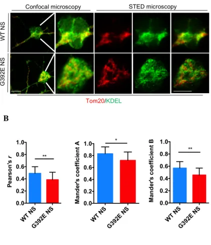 Figure  12.  Evaluation  of  ER-mitochondria  contact  regions  with  STED  confocal  microscopy