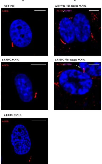 Figure 15. p.Arg330Gln KCNH1 mutation affects cilia morphology in quiescent cells. 