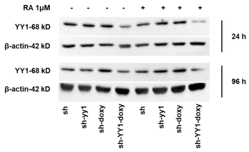 Figure 5: YY1 knockdown in HL-60 cell line treated with RA for 96 hours. 