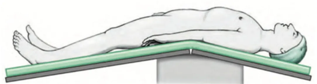 Figura	7	Posizione	del	paziente	sul	tavolo	operatorio	 	 	 	 	 	