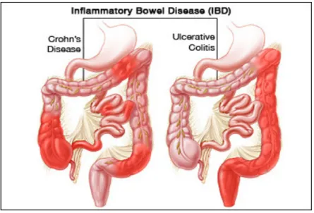 Figure 1. CD versus UC 