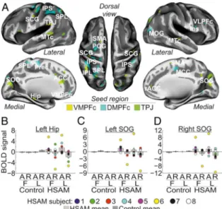 Figure 3. a) Regions showing functional connectivity with the left VMPFc (yellow map),  the  left  DMPFc  (cyan  map),  and  the  left  TPJ  (green  map)  during  access  to  autobiographical memory in the HSAM group overlaid on an inflated template (see a