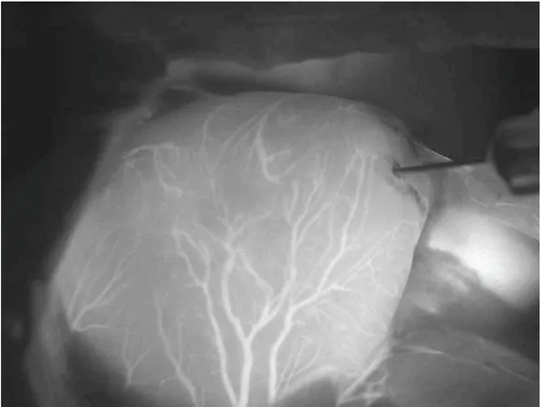 Figura 4 A typical NIRF angiography image: heart of a rat. Coronary arteries clearly visible