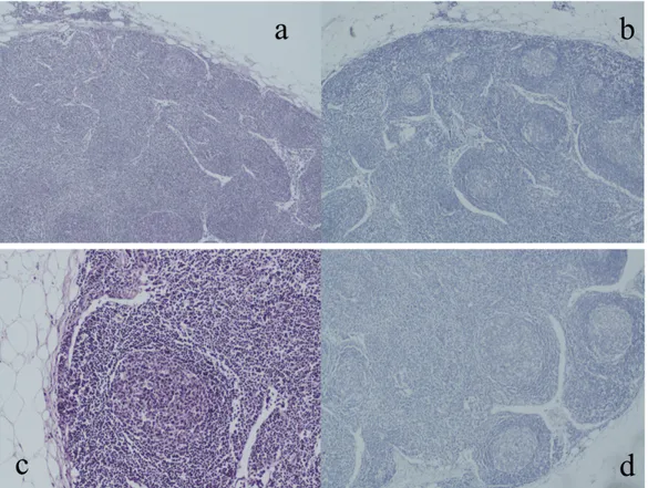 Figura 8 SLN: a) e c) colorazione con E/E con magnificazione 4X e 10X che mostra un linfonodo negativo per  cellule neoplastiche; b) e d) colorazione immunoistochimica per le citocheratine A1 e A3 con magnificazione  4X e 10X negativa per cellule neopl