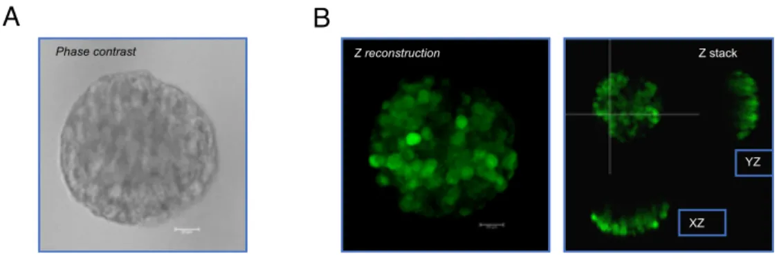 Figure 6: Confocal microscope images of 3D cultures of U87. Image of an organoid in bright 