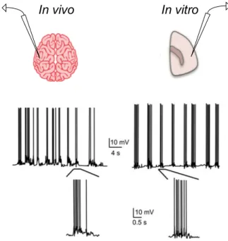 Figure 1.2: Cortical Slow Oscillations. Generation of the slow oscillations in vivo (intracellular recording of primary visual cortex of anesthetized cat) and in vitro (intracellular recording of slices of ferret visual cortex)