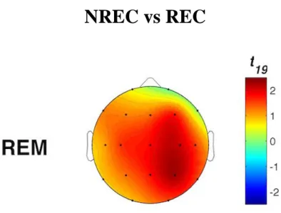 Figura 6. Confronti statistici test t di Student previsti tra gli indici di attivazione corticale tra REC e NREC per il  sonno REM