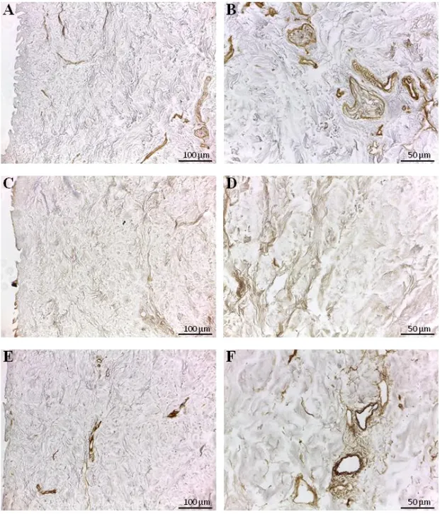 Figure  7.  Immunodetection  of  collagen  type  I,  III  and  IV  in  d-HuSk.  Representative  images  of  the  immunohistochemical  analysis  showing  the  presence  and  localization  of  the  main  cardiac  collagenous  components  in   d-HuSk: the fib