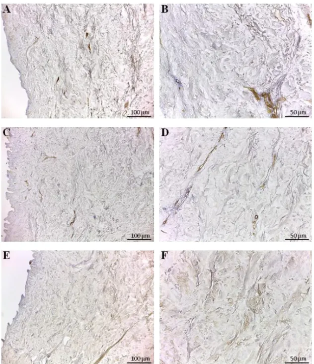 Figure 8. Immunodetection of fibronectin, laminin and tenascin in d-HuSk.  Representative  images  of  the  immunohistochemical  analysis  showing  the  presence and distribution of fibronectin (A, B), laminin (C, D) and tenascin (E, 