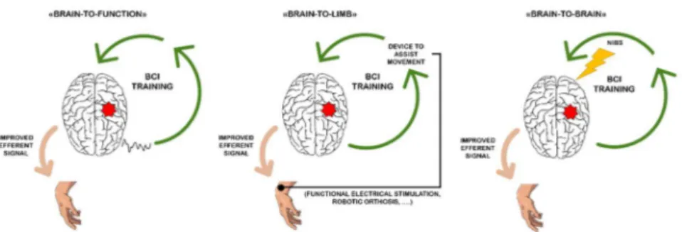 Figure 2: Overview of the Brain Computer Interface (BCI) applicability in poststroke rehabilitation