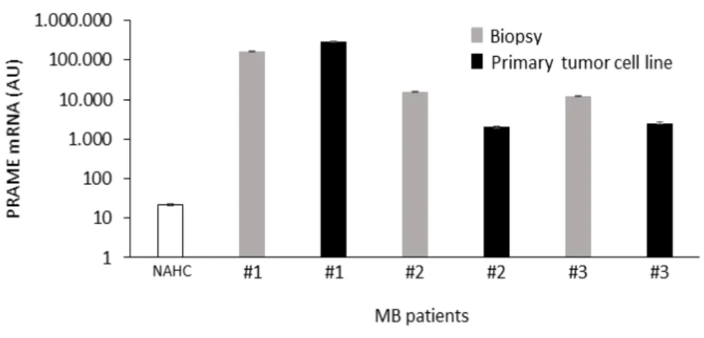 Figure  9.  A,  proliferation  analysis  of  Vβ1+  CD4+  and  Vβ1+  CD8+  T  cells  exposed  to  HLA-A*002+ PRAME+ cell line