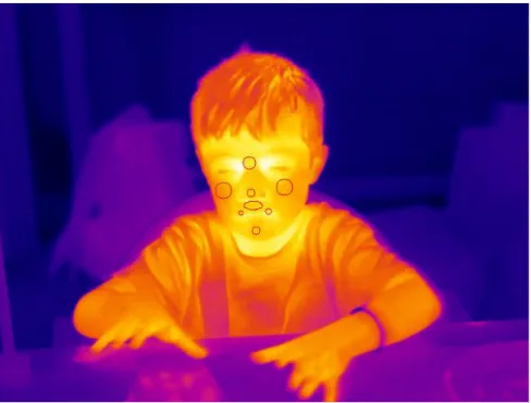 Figure 8. Thermal video image during the Probabilistic Choice Task. 
