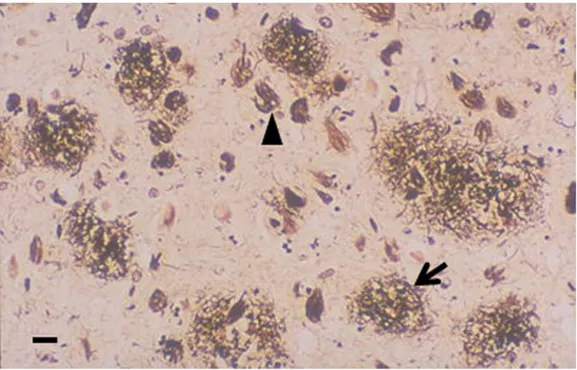 Figure 2. Histopathology of AD senile plaques (arrow) and neurofibrillary tangles (arrowhead) are detected by silver staining of 