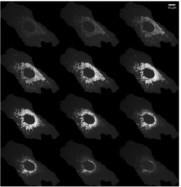 Figura 7: Dall'alto in basso e da sinistra verso destra vediamo le slices da 3 a 14 dallo stack di immagini di una cellula, quelle precedenti e le successive non mostrano alcun particolare interessante e non vengono dunque mostrate