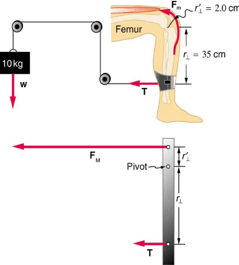 Figura 7. Una massa è collegata da pulegge e fili alla caviglia in questo dispositivo per  esercizi.