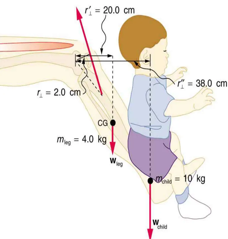 Figura 11. Un bambino sollevato dalla parte inferiore della gamba di un padre. 10. A differenza della maggior parte degli altri muscoli del nostro corpo, il muscolo  massetere della mascella, come illustrato nella Figura 12, è attaccato relativamente  lont