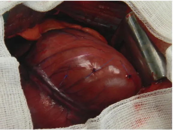 Figure 24. Injection of 3 different AAV serotypes in 3 different sites of the left ventricular  anterior wall  