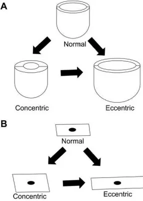 Fig. 3. Macroscopic and microscopic changes during cardiac hypertrophy  54