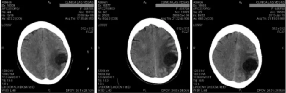 Figure 1 – Original CT images at intervals of one month