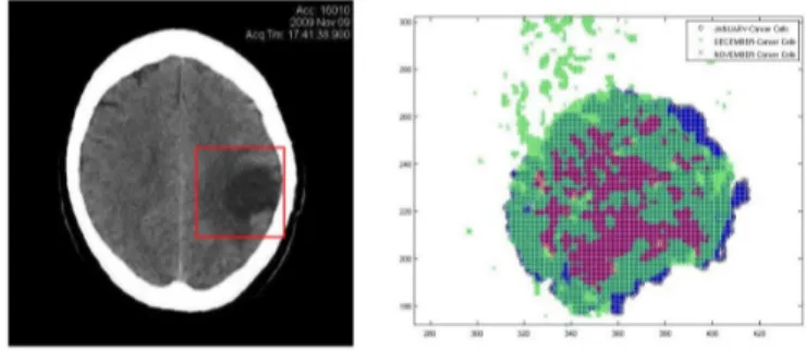 Figure 2 – ROI in the registered images (left) and infected cells (right)