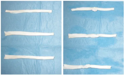 Fig. 1 Tendons before and after the suture: repair site distortion with the modified Kessler technique (above), with the new 4-strand barbed technique with 2/0 polypropylene Quill TM SRS (center) and with the new 4-strand barbed technique with 2/0 PDO Quil