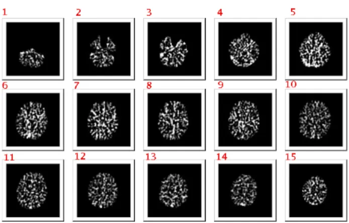Figure 2: A view of a set of brain slices.