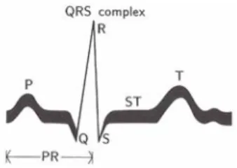 Fig. 4. ECG curve corresponding to one beat of the normal heart. P: wave of depolarization of the atrial myocardium