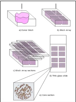 Figure 3 - Tissue Microarray Technique scheme. 