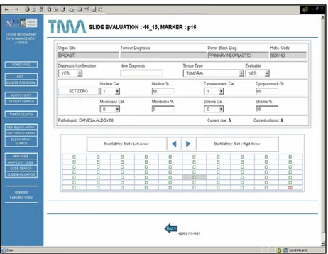 Figure 9 - Biomarker evaluation: TMABoost interface; the upper  window shows the image of the selected core section