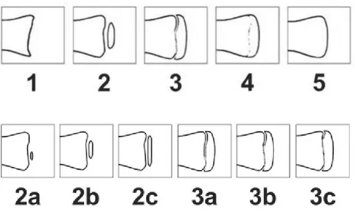 Figure 3.  Sub-staging of clavicle original 2 and 3 Stages [46] 
