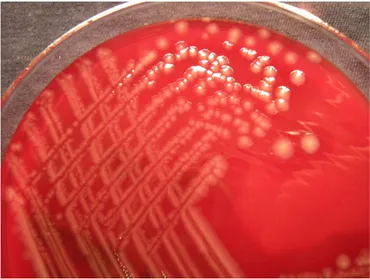 FIG. 4 ––Clostridium perfringens on blood agar, showing double zone of beta-hemolysis