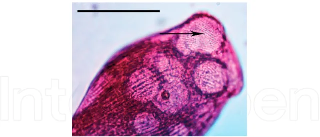 Figure 13.  Extrusive pigment granules in Blepharisma japonicum (arrow) visible as red/pink dots under a vacuole