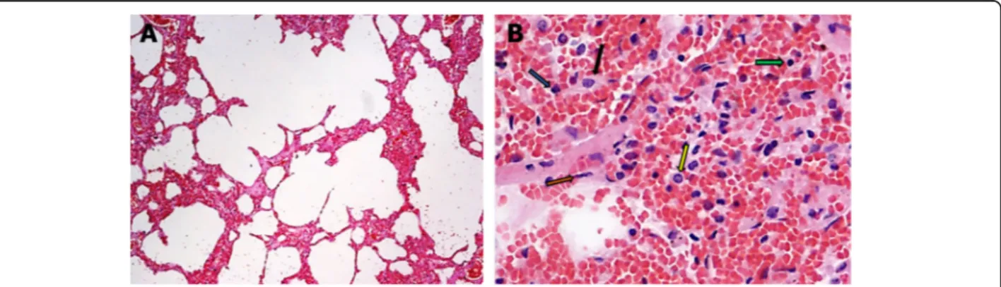 Fig. 1 Histological changes in case 1. a Exudative phase of acute interstitial pneumonia (hematoxylin and eosin stain, × 100)