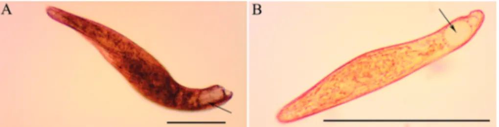 Figure 1. Micrographs of living cells of A, Blepharisma stoltei and B, Blepharisma undulans