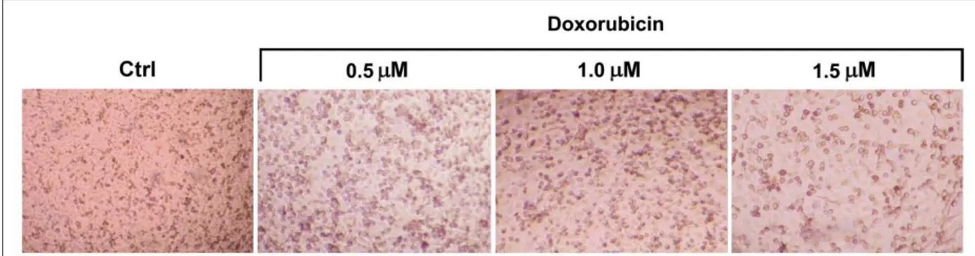Figure  3.  Representative  photographs  of  MDA-MB-231  cells  (control  and  after  treatment  with 