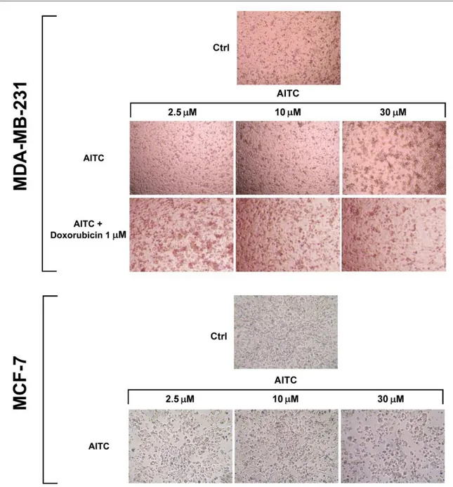 Figure  5.  Representative  photographs  of  MDA-MB-231  and  MCF-7  cells  (control  and  after 