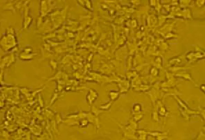 Figura 9. Cellule differenziate di neuroblastoma umano della linea cellulare SH-SY5Y 