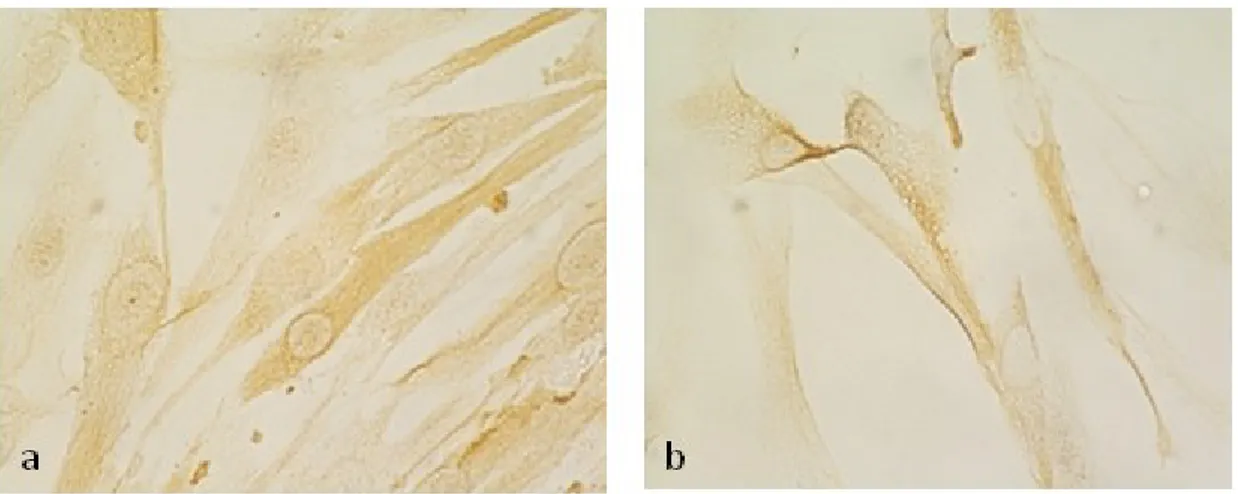 Figure  11.  .Immunocytochemical  staining  of  RKIP  in    leiomyoma  (a)  and    myometrial  (b)  cells