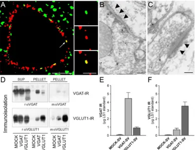 Figura  8.  Evidenza  della  co-espressione  di  VGLUT1  e  VGAT  nelle  sinapsi  corticali  del  ratto  adulto