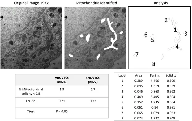 Figure  7.  TEM  analysis  of  mitochondrial  morphology  in  endothelial  cell.  A  representative  image  of 