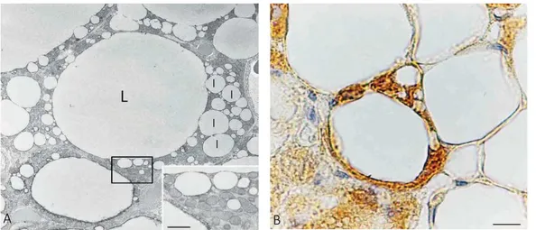 Figure  10.  Paucilocular  adipocytes.  A)  Transmission  electron  microscopy  of  subcutaneous  fat  of  a  cold 