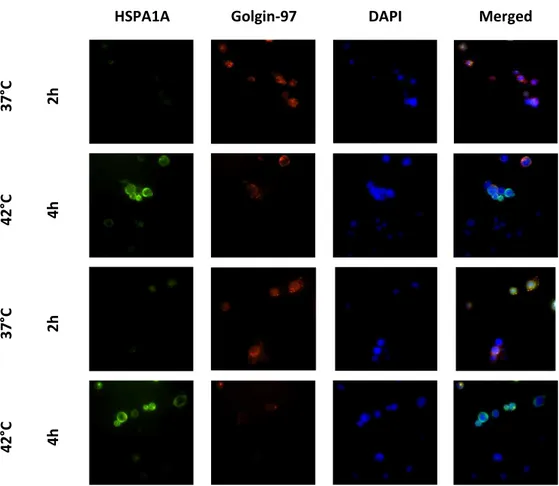 Figure 11: HSPA1A co-localization with Golgi marker after  2 and 4 hours heat shock  