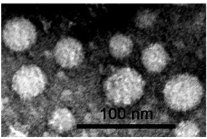 Figure 17: Exosome analysis and HSPA1A localization following heat shock treatment 