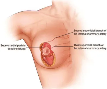 Fig.  2.1  Vascolarizzazione  del  peduncolo  superomediale 