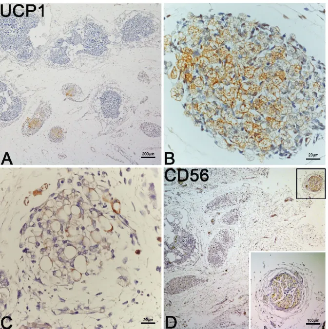Figura  7:  A.  Immunoistochimica  contro  la  proteina  UCP1  su  campione  latero  cervicale del gruppo early