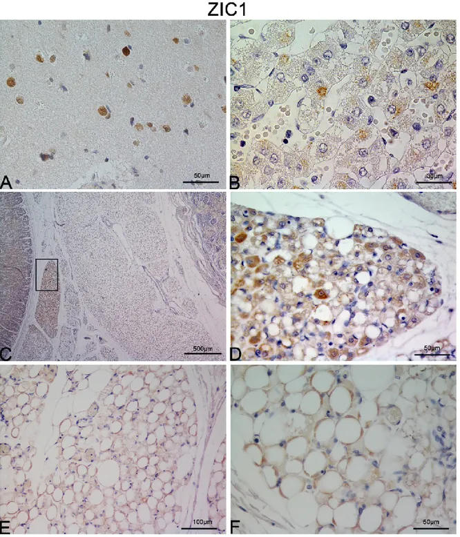 Figura  14:  A.B.  Immagini di immunoistochimica di cervelletto (A) e surrene (B)  usati  come  controlli  positivi  per  il  marker  ZIC1