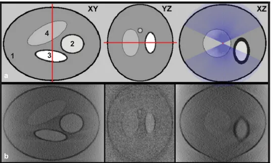 Fig 2. (a) Digital phantom simulating 4 organelles. The tilt axis is marked in red and the tilting angles ( ±65˚) for the projections are marked in purple lines; (b) reconstruction from simulated X-ray microscope data